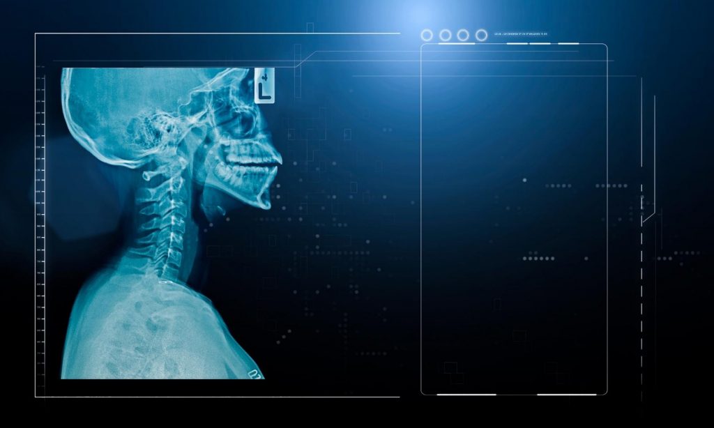 Wirbelsäule Aufbau 
Wirbelsäule energetische Bedeutung
Wirbelverschiebungen und deren Folgen